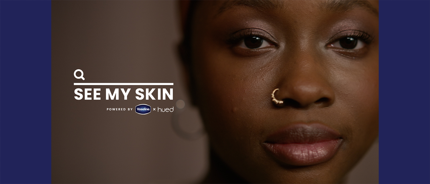 Vaseline's ‘See My Skin’ Campaign Skin Care Equity