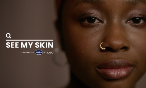 Vaseline’s Efforts to End Skin Inequity